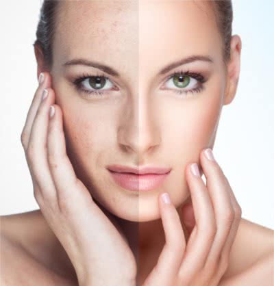 cosmelan reklama efekt dzialania.  <?echo $add_image;?>