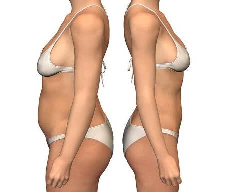  PerfectLift Robert Janczura Medycyna Estetyczna Kraków Kielce Aqualyx, Nici BARB 4D, Laser CO2, VPL, Cosmelan, powiększanie ust, botox, botoks, makijaż permanentny, kwas hialuronowy, wypełniacze, mezoterapia, lifting twarzy