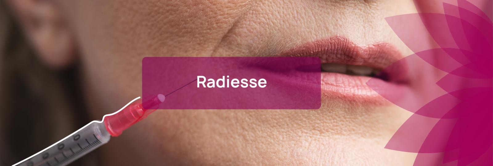Radiesse - stymulator z hydroksyapatytu wapnia